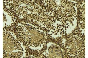 ABIN6277431 at 1/100 staining Mouse testis tissue by IHC-P. (RAD50 Antikörper  (Internal Region))