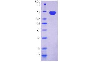 SDS-PAGE (SDS) image for Cadherin 5 (CDH5) (AA 67-390) protein (His tag) (ABIN6237725)