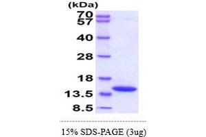 SDS-PAGE (SDS) image for D-Dopachrome Tautomerase (DDT) (AA 21-248) protein (His tag) (ABIN5855098)