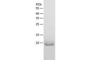 Western Blotting (WB) image for Bromodomain PHD Finger Transcription Factor (BPTF) (AA 2796-2907) protein (His tag) (ABIN7122052) (BPTF Protein (AA 2796-2907) (His tag))