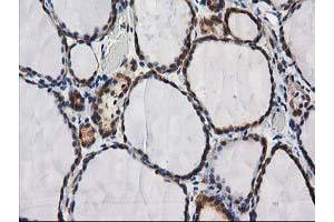 Image no. 1 for anti-Destrin (Actin Depolymerizing Factor) (DSTN) antibody (ABIN1497910) (Destrin Antikörper)