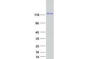 Western Blotting (WB) image for Ras and Rab Interactor 3 (RIN3) protein (Myc-DYKDDDDK Tag) (ABIN2730930)