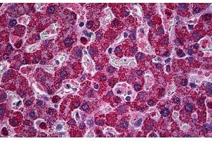 Human Liver: Formalin-Fixed, Paraffin-Embedded (FFPE) (PIM1 Antikörper  (AA 1-314))