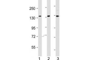 Western blot testing of AATK antibody at 1:2000 dilution.