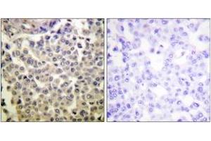 Immunohistochemistry (IHC) image for anti-P21-Activated Kinases 1/2/3 (PAK1/2/3) (AA 391-440), (pThr423) antibody (ABIN1531366)