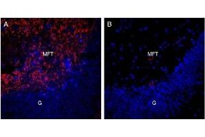 Expression of Alpha-Synuclein in rat hippocampus.
