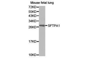 Western Blotting (WB) image for anti-Surfactant Protein A1 (SFTPA1) antibody (ABIN1874759) (Surfactant Protein A1 Antikörper)