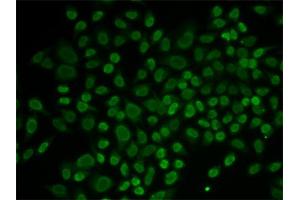 Immunofluorescence analysis of MCF-7 cells using RAD54L2 antibody. (ARIP4 Antikörper)