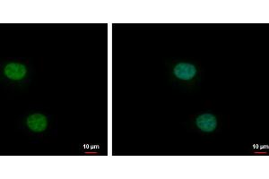 ICC/IF Image XLF antibody [N3C3] detects XLF protein at nucleus by immunofluorescent analysis. (NHEJ1 Antikörper)