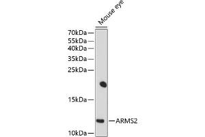 Western blot analysis of extracts of mouse eye, using  antibody (ABIN6129951, ABIN6137123, ABIN6137124 and ABIN6214318) at 1:1000 dilution. (ARMS2 Antikörper  (AA 1-107))