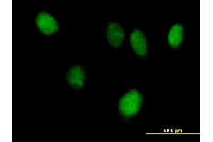 Immunofluorescence of purified MaxPab antibody to STAT6 on HeLa cell.