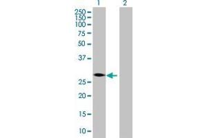 Western Blotting (WB) image for ZBTB32 293T Cell Transient Overexpression Lysate(Denatured) (ABIN1335941)