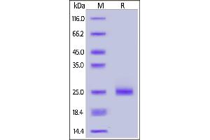 SDS-PAGE (SDS) image for Interleukin 17C (IL17C) (AA 19-197) (Active) protein (His tag) (ABIN6952297)