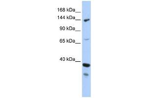 DHX37 antibody used at 1 ug/ml to detect target protein. (DHX37 Antikörper)