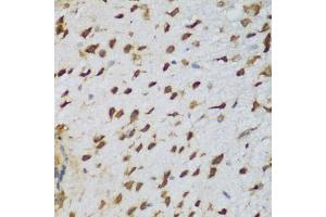 Immunohistochemistry of paraffin-embedded mouse brain using NCL antibody (ABIN5975400) at dilution of 1/200 (40x lens). (Nucleolin Antikörper)