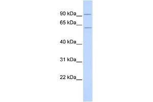 WB Suggested Anti-CUGBP2 Antibody Titration:  0. (CELF2 Antikörper  (N-Term))