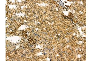 ABIN6263913 and ABIN6266606 at 1/100 staining Rat kidney tissue by IHC-P.