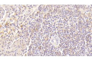 Detection of GM-CSF in Human Spleen Tissue using Polyclonal Antibody to Colony Stimulating Factor 2, Granulocyte Macrophage (GM-CSF) (GM-CSF Antikörper  (AA 18-144))