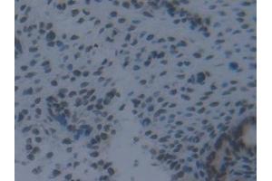 Immunohistochemistry (IHC) image for anti-Interferon Regulatory Factor 2 (IRF2) (AA 1-349) antibody (ABIN7442543)