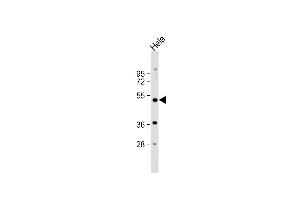 Anti-NR1I2 Antibody (Center) at 1:1000 dilution + Hela whole cell lysate Lysates/proteins at 20 μg per lane. (NR1I2 Antikörper  (AA 100-127))