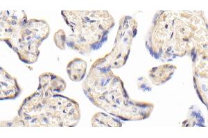 Immunohistochemistry (IHC) image for anti-Insulin Receptor (INSR) (AA 1024-1298) antibody (ABIN7432874)