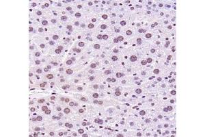 Immunohistochemistry (Paraffin-embedded Sections) (IHC (p)) image for anti-MDS1 and EVI1 Complex Locus (MECOM) antibody (ABIN7074575)