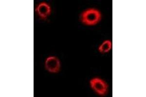 Immunofluorescent analysis of TBRG4 staining in Hela cells. (TBRG4 Antikörper)