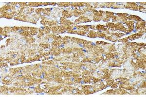 Immunohistochemistry of paraffin-embedded Mouse heart using TRAP1 Polyclonal Antibody at dilution of 1:100 (40x lens). (TRAP1 Antikörper)