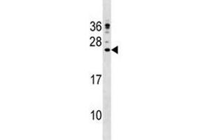 CAMP antibody western blot analysis in NCI-H292 lysate (Cathelicidin Antikörper  (AA 123-152))