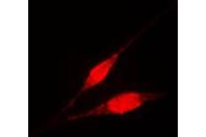 Immunofluorescent analysis of IKK gamma staining in HL60 cells.