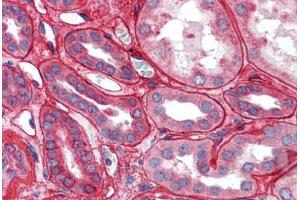 Kidney: Formalin-Fixed Paraffin-Embedded (FFPE) (Collagen IV Antikörper)