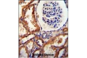 DNAJC22 antibody (C-term) (ABIN654825 and ABIN2844500) immunohistochemistry analysis in formalin fixed and paraffin embedded human kidney tissue followed by peroxidase conjugation of the secondary antibody and DAB staining. (DNAJC22 Antikörper  (C-Term))