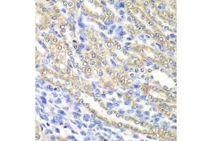 Immunohistochemistry of paraffin-embedded rat kidney using SURF1 antibody at dilution of 1:100 (x40 lens). (SURF1 Antikörper)