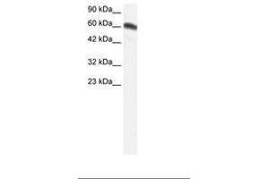 Image no. 1 for anti-Forkhead Box C2 (MFH-1, Mesenchyme Forkhead 1) (FOXC2) (AA 212-261) antibody (ABIN202667) (FOXC2 Antikörper  (AA 212-261))