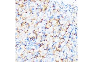 Immunohistochemistry of paraffin-embedded rat ovary using Filamin A Rabbit mAb (ABIN1682545, ABIN3018024, ABIN3018025 and ABIN7101570) at dilution of 1:100 (40x lens). (Filamin A Antikörper)