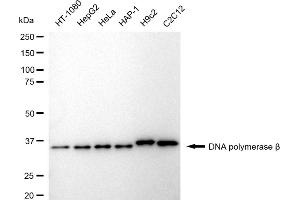 Western blotting analysis using DNA polymerase beta antibody (ABIN7799875). (Rekombinanter POLB Antikörper)