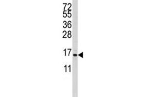 Western blot analysis of S100A11 antibody and CEM lysate. (S100A11 Antikörper  (AA 1-30))