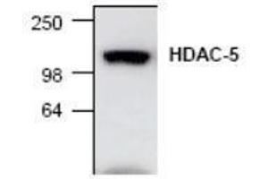 Image no. 1 for anti-Histone Deacetylase 5 (HDAC5) antibody (ABIN127240) (HDAC5 Antikörper)