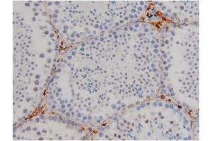 Immunohistochemistry (IHC) image for anti-V-Yes-1 Yamaguchi Sarcoma Viral Related Oncogene Homolog (LYN) (pTyr507) antibody (ABIN6256754)