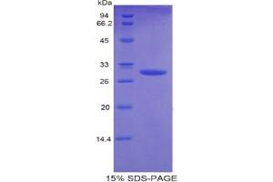 SDS-PAGE analysis of Mouse Plastin 3 Protein. (Plastin 3 Protein (PLS3))