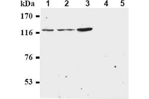 Western Blotting (WB) image for anti-Budding Uninhibited By Benzimidazoles 1 Homolog beta (Yeast) (BUB1B) antibody (ABIN567606) (BUB1B Antikörper)