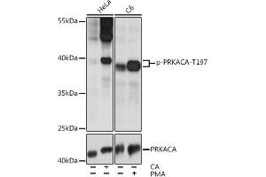 Western blot analysis of extracts of various cell lines, using Phospho-PKA C-alpha (PRKACA)-T197 pAb (ABIN6135290, ABIN6136202, ABIN6136203 and ABIN6225582) at 1:2000 dilution or PKA C-alpha (PRKACA) antibody (ABIN7269625).