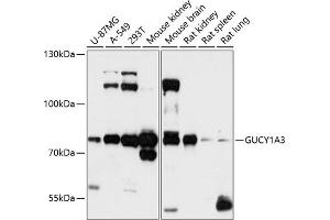 Western blot analysis of extracts of various cell lines, using GUCY1 antibody (ABIN6127969, ABIN6141533, ABIN6141534 and ABIN6216446) at 1:3000 dilution. (GUCY1A1 Antikörper  (AA 1-120))