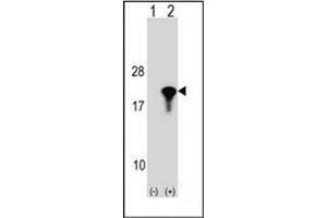 Western blot analysis of PPIL1 (arrow) using PPIL1 Antibody (Center) Cat.