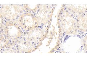Detection of GNb2 in Human Kidney Tissue using Polyclonal Antibody to G Protein Beta 2 (GNb2) (GNB2 Antikörper  (AA 2-340))