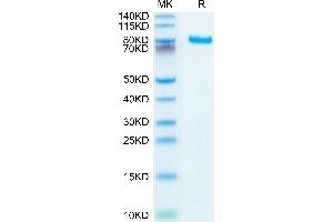 Human DLL4 on Tris-Bis PAGE under reduced conditions. (DLL4 Protein (AA 27-524) (Fc Tag))