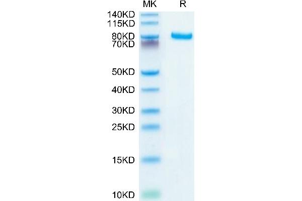 DLL4 Protein (AA 27-524) (Fc Tag)
