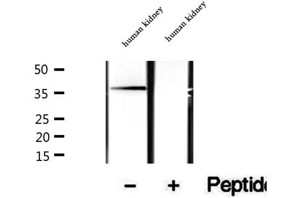 SUGT1 Antikörper  (C-Term)