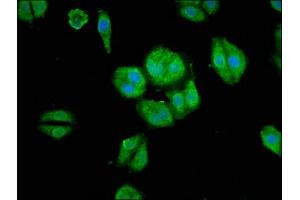 Immunofluorescence staining of HepG2 cells with ABIN7167935 at 1:66, counter-stained with DAPI.