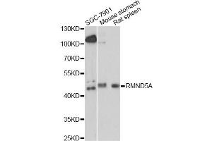 Western blot analysis of extracts of various cell lines, using RMND5A antibody. (RMND5A Antikörper)